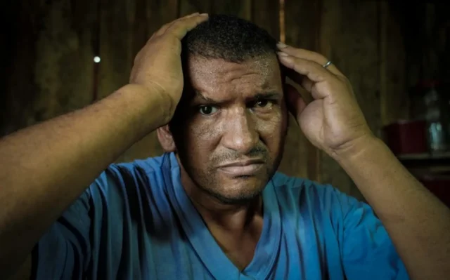 Massacre de Eldorado do Carajás: sobrevivente tem bala no olho há 30 anos